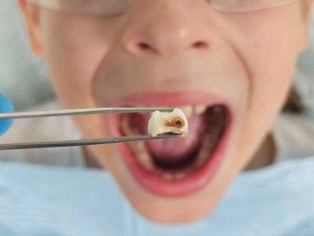 Best Emergency Treatment for Jaw Pain or Injury in Portage, PA
